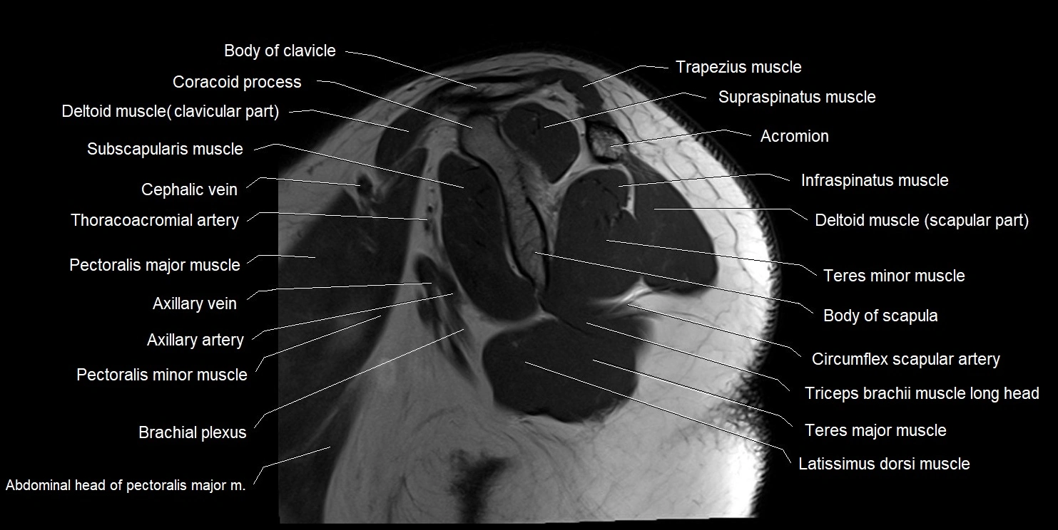 mri shoulder sagittal cross sectional anatomy image 4.webp